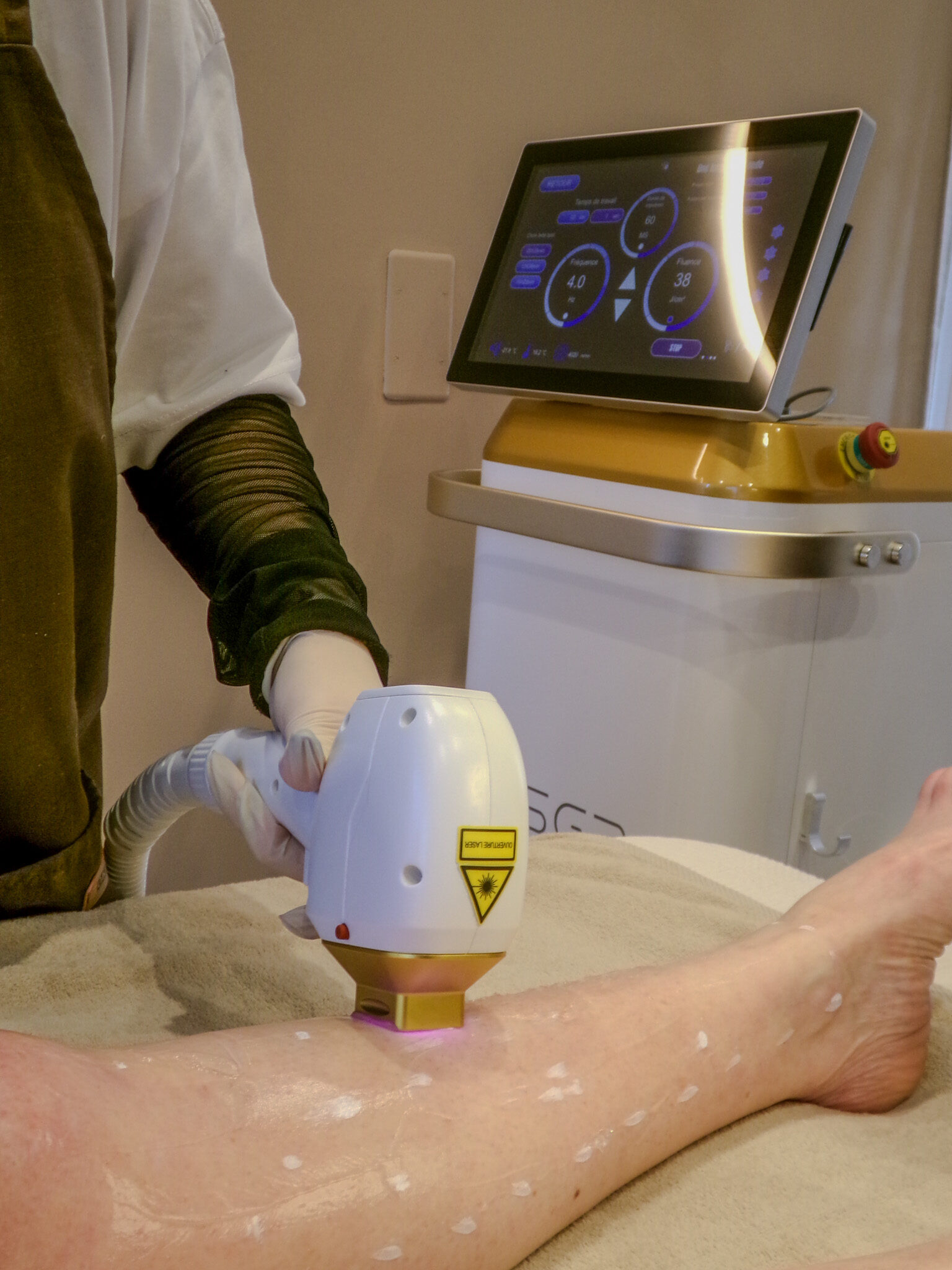 Séance d’épilation laser professionnelle chez lestudiomarilou à Castelnaudary sur jambe préparée avec crème